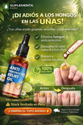 DI ADIOS A LOS HONGOS EN LAS UÑAS: ANTI HONGO / ELIMINA HONGO DE UÑAS